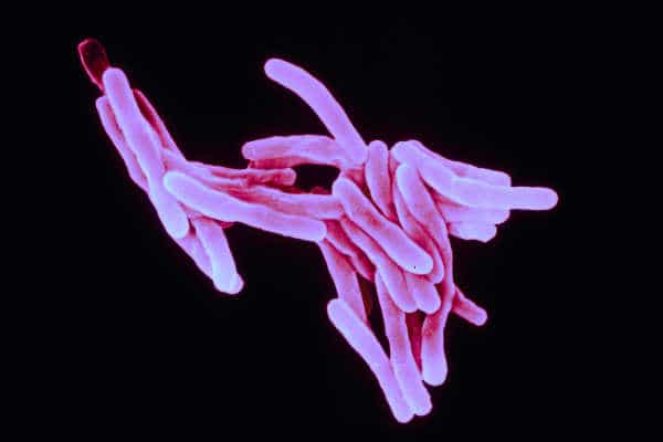 tuberculosis